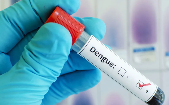 dengue fever test tube