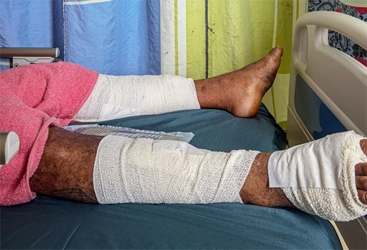 Man with legs bandaged from pig attack