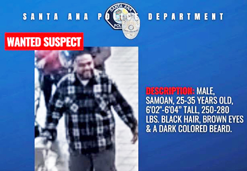 SANTA ANA ASSAULT SUSPECT