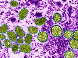monkeypox virus, shown here in a colored electron micrograph