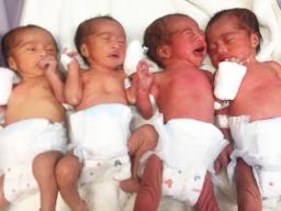 The quadruplets - all girls - who were delivered at the LBJ Hospital this past weekend.