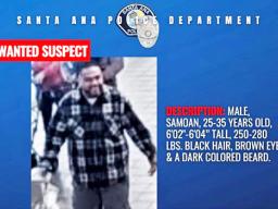 SANTA ANA ASSAULT SUSPECT