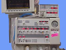 Example of a ventilator 