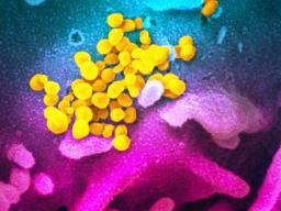 electron microscope image of SARS-CoV-2