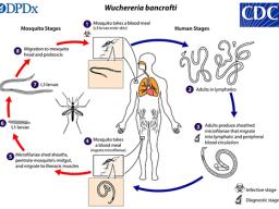 The causative agents of lymphatic filariasis