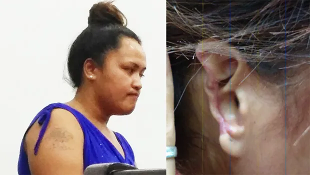 Left is Taumasina Falaniko and right is photo of Levi Saleimoa"s mutulated ear