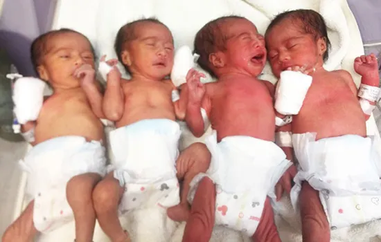 The quadruplets - all girls - who were delivered at the LBJ Hospital this past weekend.