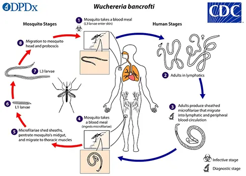 The causative agents of lymphatic filariasis